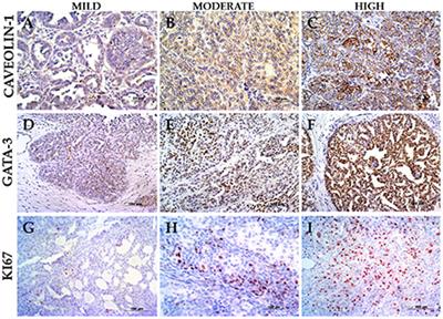 Caveolin-1, GATA-3, and Ki67 expressions and their correlation with pathological findings in canine bladder urothelial carcinoma